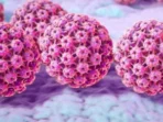 Virus HPV Bisa Jadi Penyebab Kanker Dini